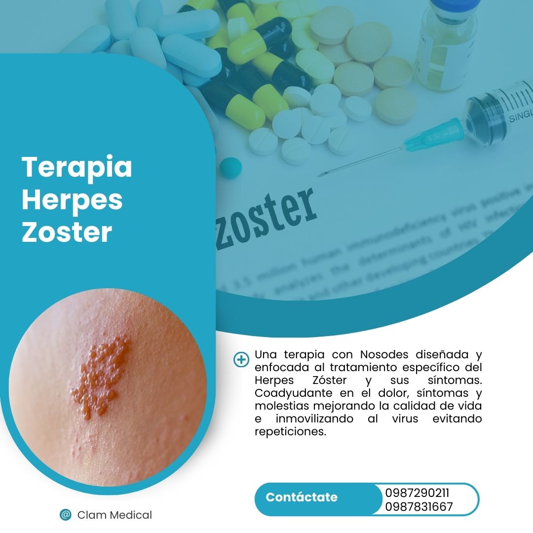 Terapia de herpes zoster