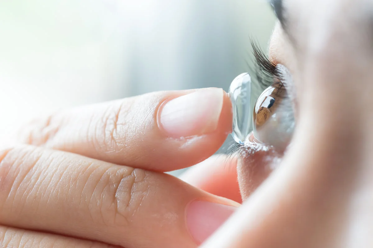 ADAPTACION  DE LENTES DE CONTACTO