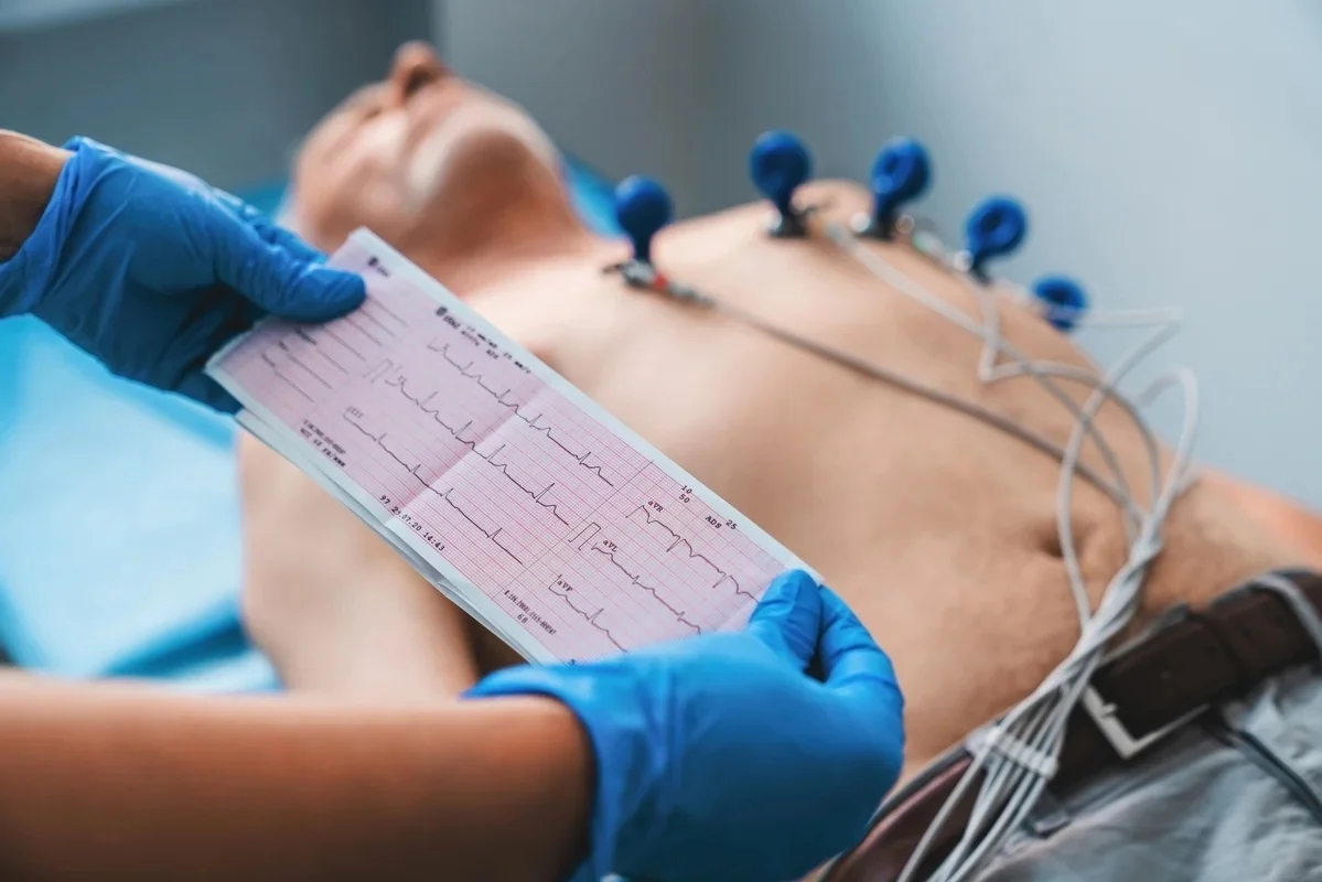 Pruebas Basadas en Electrocardiograma (ECG)