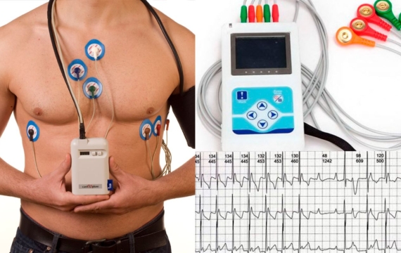 HOLTER DE ARRITMIAS
