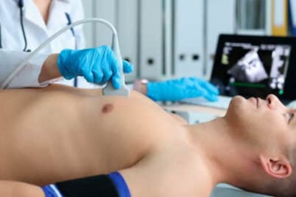 ECOCARDIOGRAMA DE ESTRÉS