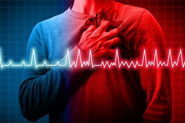 INSUFICIENCIA CARDIACA