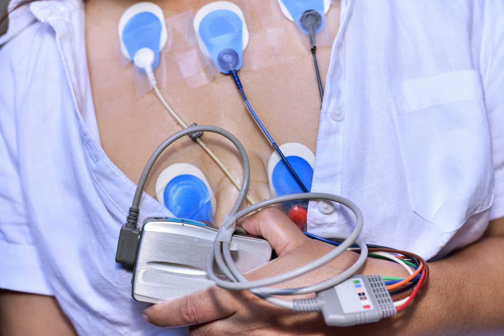 HOLTER DE ARRITMIAS