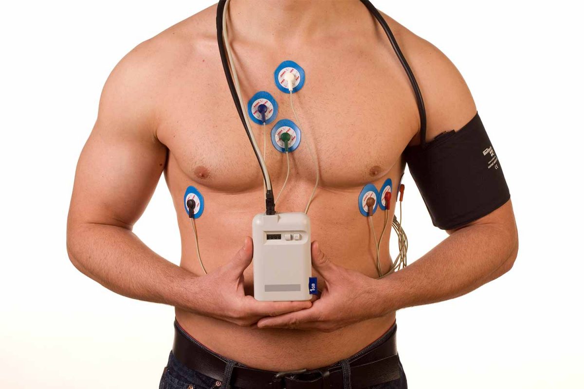 ELECTROCARDIOGRAMA – MAPA